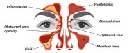 THE DOCTORS 101 CHRONIC SYMPTOMS CONDITIONS 2 NASAL CONGESTION 