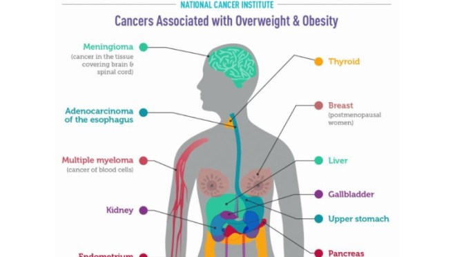 INFOGRAPHIC: A LOOK AT “CANCERS ASSOCIATED WITH OVERWEIGHT & OBESITY
