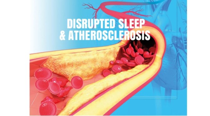 STUDY: “FRAGMENTED SLEEP” INCREASES INFLAMMATION & HARDENING OF THE ARTERIES