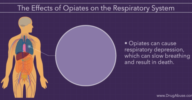 INFOGRAPHICS: “THE EFFECTS OF OPIATES ON THE BODY”