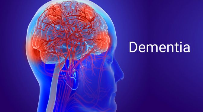 Aging: Mild Cognitive Impairment Vs Dementia