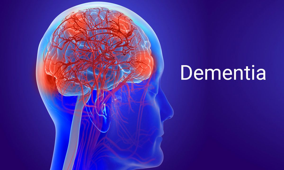 Aging Mild Cognitive Impairment Vs Dementia Doctors Without Waiting