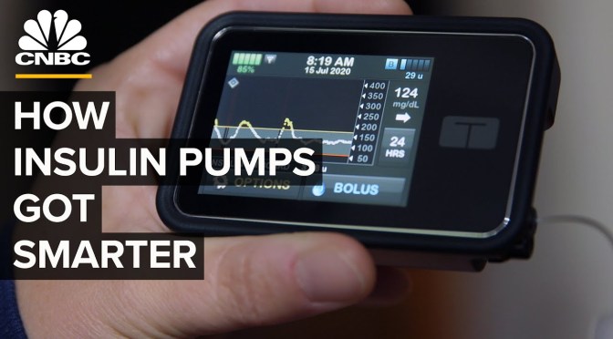 DIABETES MANAGEMENT: “SMART INSULIN PUMPS”