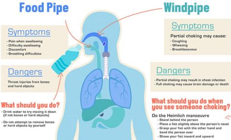 the-doctors-101-chronic-symptoms-conditions-9-choking-food