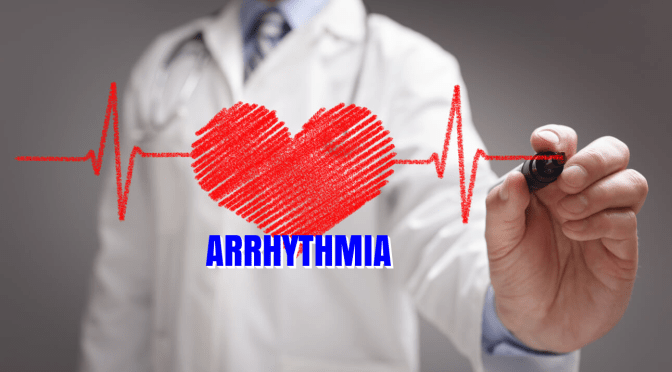 HEART ARRYTHMIAS: “ATRIAL FIBRILLATION” (AFIB)