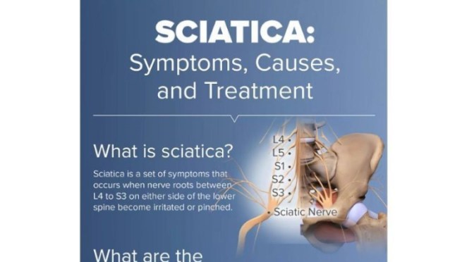 INFOGRAPHIC: “SCIATICA – SYMPTOMS & TREATMENT”