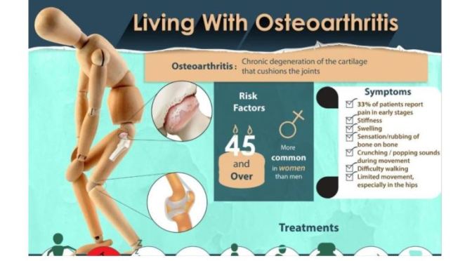 STUDIES: OSTEOARTHRITIS PATIENTS USING EXERCISE THERAPY HAVE LESS PAIN, CUT OPIOID & ANALGESIC USE