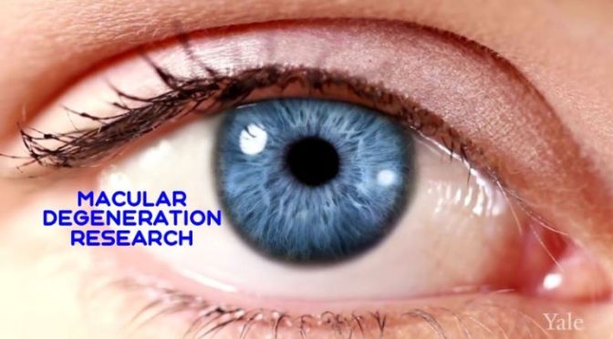 MEDICAL VIEWS: ‘MACULAR DEGENERATION RESEARCH’