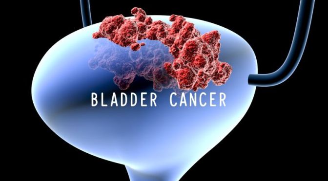 Mayo Clinic: Bladder Cancer Explained
