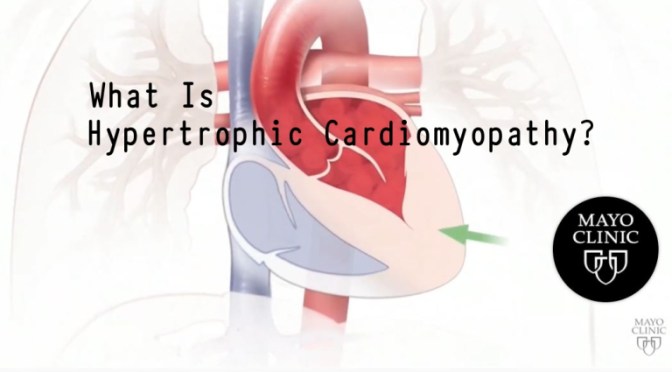 MAYO CLINIC HEART HEALTH: ‘WHAT IS HYPERTROPHIC CARDIOMYOPATHY? ‘ (VIDEO)