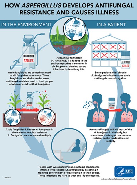 Fungal Infections In The Lungs: Aspergillus | Doctors Without Waiting Rooms
