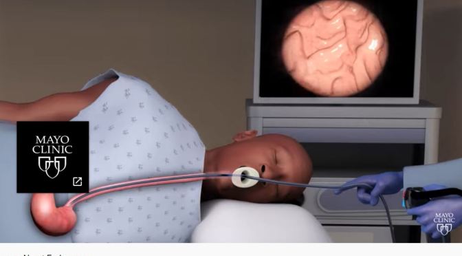 Procedures: Endoscopy Of Stomach & Intestine