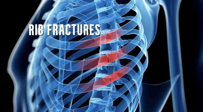 Dr. C’s Journal: Rib Fractures & Cracks