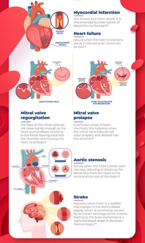 INFOGRAPHIC: TYPES AND CAUSES OF HEART DISEASE | Doctors Without ...