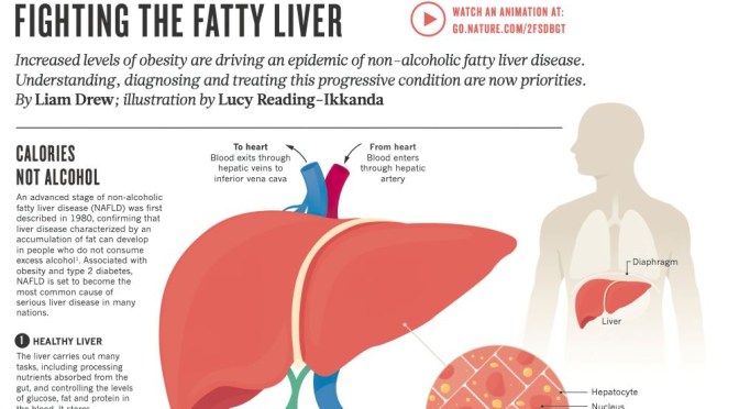 INFOGRAPHIC: FIGHTING FATTY LIVER DISEASE