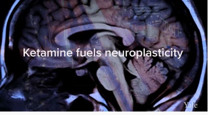 DEPRESSION: HOW KETAMINE CAN HELP (YALE MEDICINE)