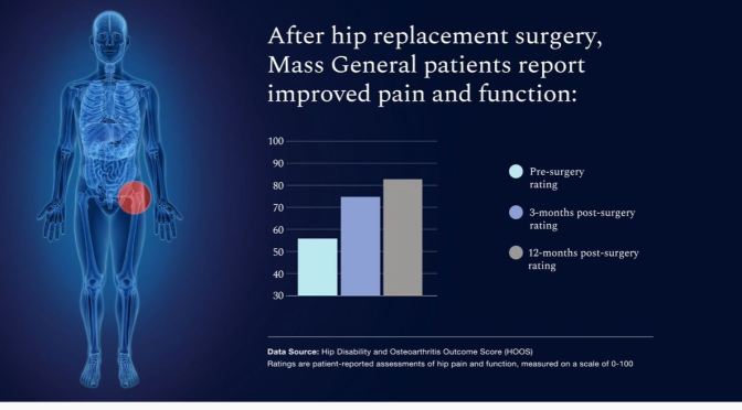 HEALTH: HIP REPLACEMENT SURGERY SUCCESS RATES