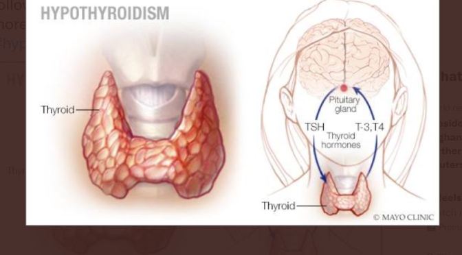 Hypothyroidism: TSH Test First, Then Hormone Test