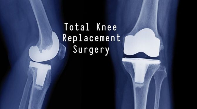DR. C’S JOURNAL: PAIN FOLLOWING TOTAL KNEE REPLACEMENT SURGERY