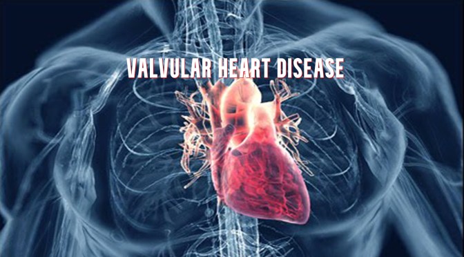 DR. C’S JOURNAL: WHAT IS VALVULAR HEART DISEASE?