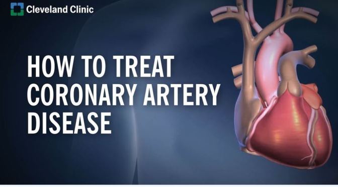 MEDICINE: HOW TO TREAT CORONARY HEART DISEASE