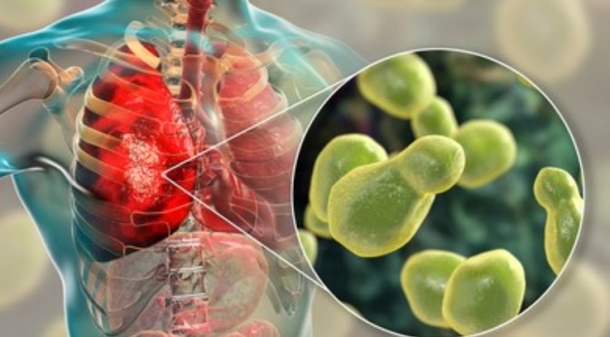 Infections: Cryptococcus Neoformans (Fungi)