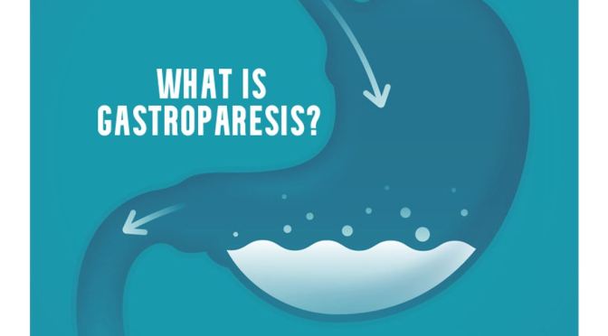 Stomach Health: What Is Gastroparesis? (Harvard)