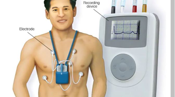 Technology: Wearable Heart Monitors (Mayo)