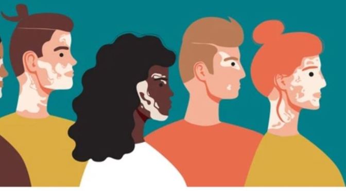 DR. C’S JOURNAL: VITILIGO