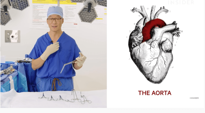 Cardiac Surgery: Major Tools Used By Surgeons