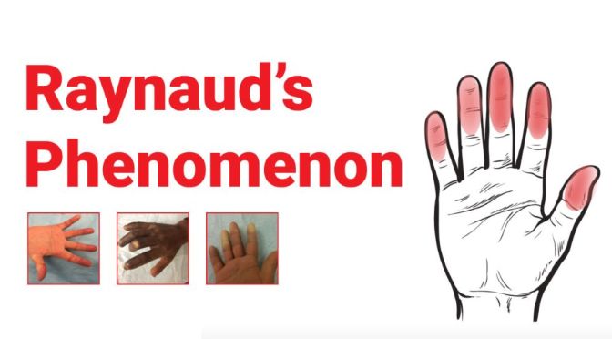 Blood Circulation: What Is Raynaud’s Phenomenon?