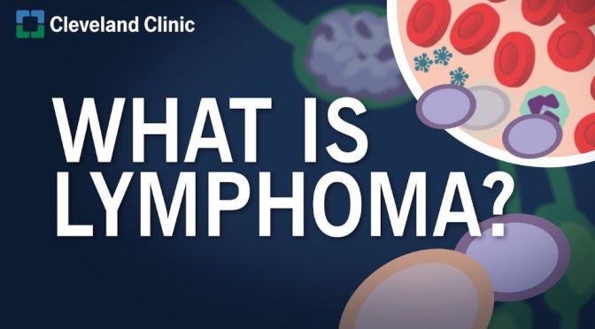 Lymphoma: Its Types And Causes (Cleveland Clinic)