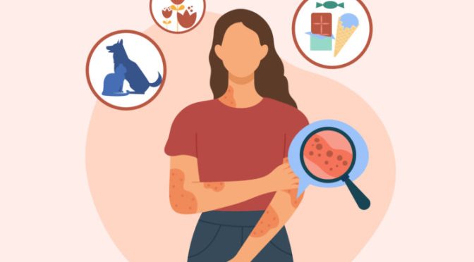 Allergic Reactions: The Symptoms & Treatments