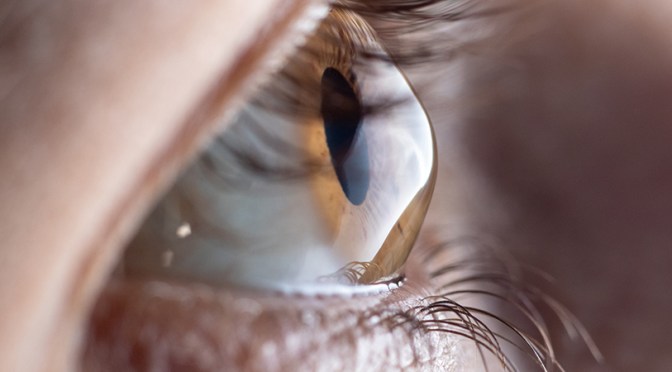 Eye Diseases: Keratoconus – Causes And Symptoms