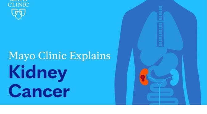Kidney Cancer: Symptoms & Treatment (Mayo Clinic)