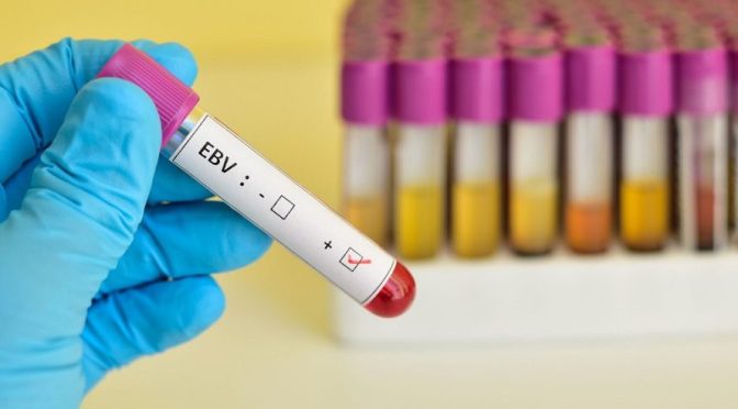 Infectious Disease: Signs & Causes Of  Mononucleosis