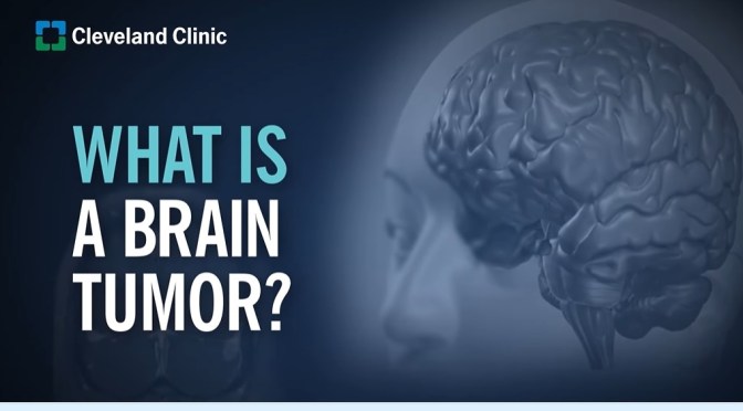 Brain Tumors: Causes And Types (Cleveland Clinic)