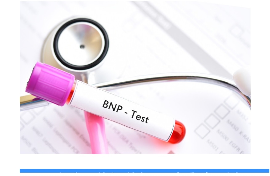Cardiac Tests: B-Type Natriuretic Peptide (BNP) | Doctors Without ...