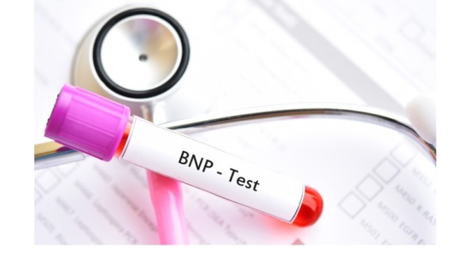 Cardiac Tests: B-Type Natriuretic Peptide (BNP)