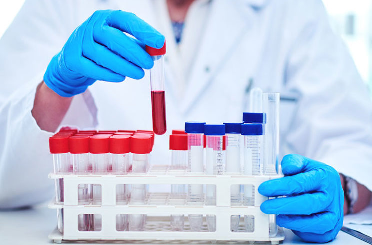 Lab Testing Meaning Opinion: Your Laboratory Tests And What They Mean | Doctors Without ...
