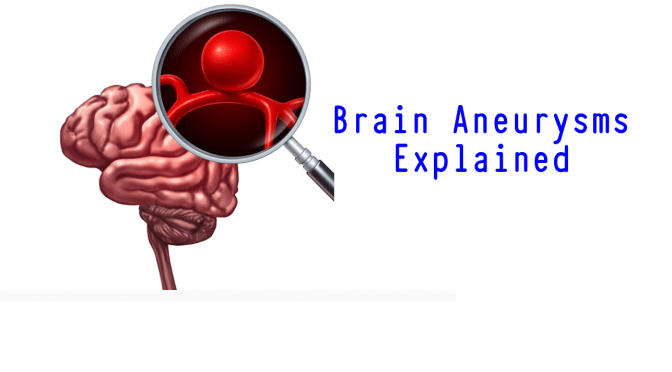 Mayo Clinic: Treatments For Brain Aneurysms