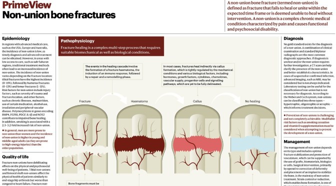 Chronic Conditions: Non-Union Bone Fractures