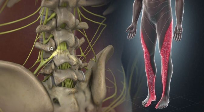 Back Pain: The Causes & Symptoms Of Sciatica
