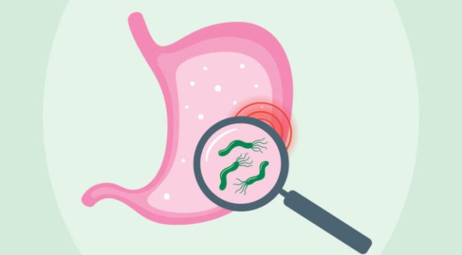 Chronic Conditions: Does Stress Cause Ulcers?