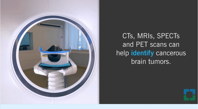 Cleveland Clinic: Primary Malignant Brain Tumors