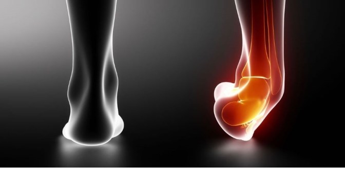 Health: How To Recover From An Ankle Sprain