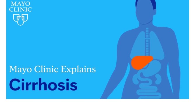 Liver Health: Diagnosis And Risks Of Cirrhosis