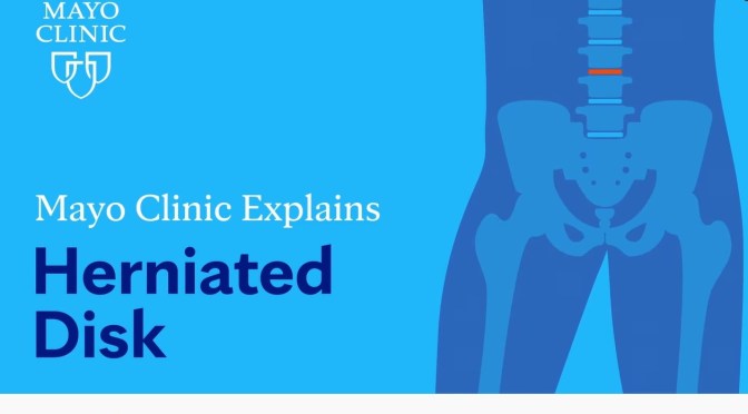 Spine Health: Diagnosing & Treating A Herniated Disk