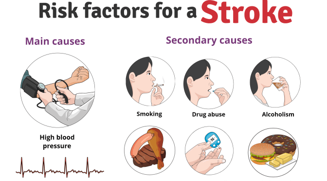 Brain Health: How To Reduce Risks Of Strokes