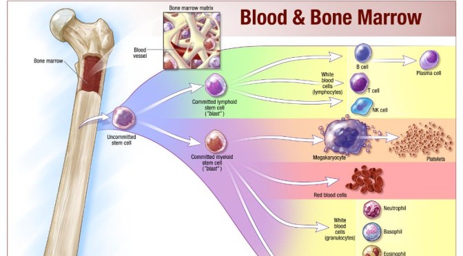 Stem Cells: Bone Marrow Transplants (Mayo Clinic)
